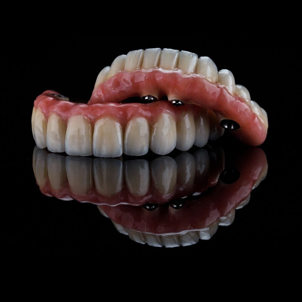 protesis-dental-removible-sobre-implantes
